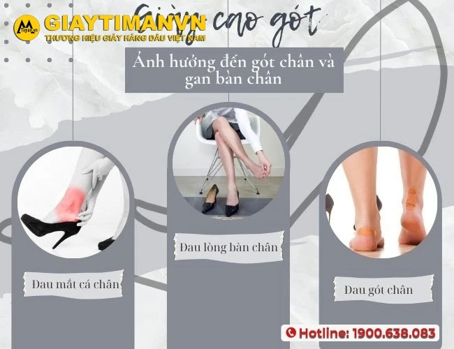Đi giày cao gót có ảnh hưởng đến sức khoẻ