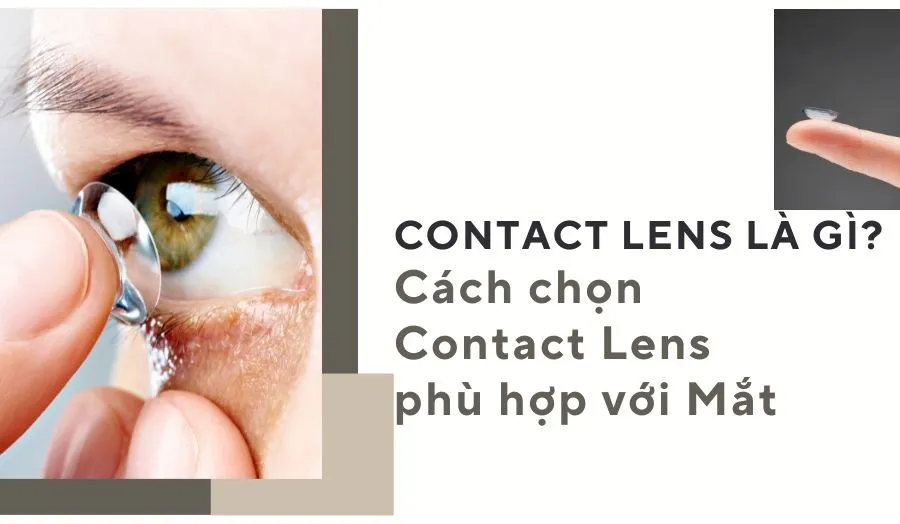 Contact Lens Là Gì? Cách Chọn Contact Lens Phù Hợp Đôi Mắt